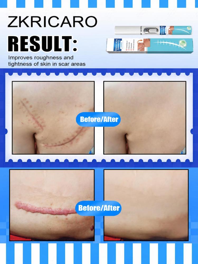 Mini Handheld Skin Surface Car - огляд і ціна Home Improvement Mark