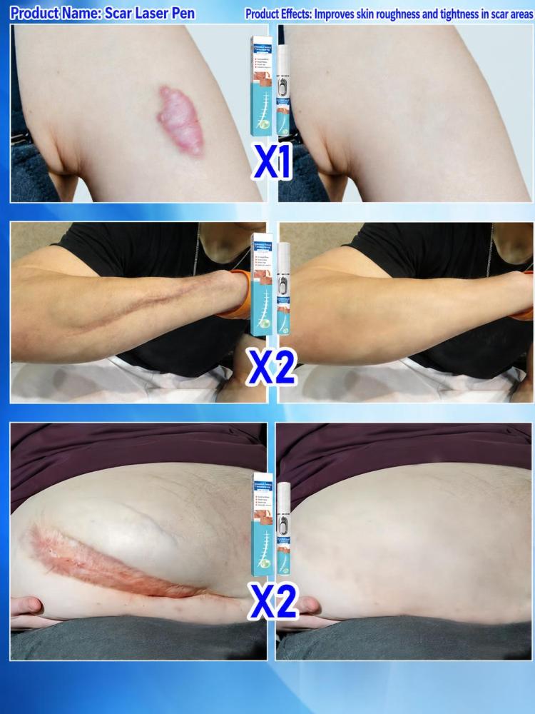 Handheld Skin Beauty Care Devi - огляд і ціна Home Improvement Mark